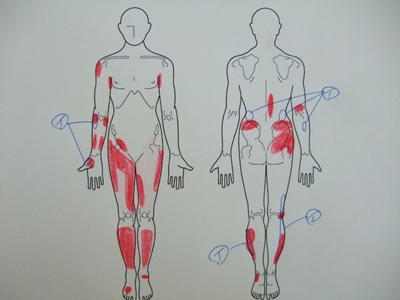 足の痛み、腰痛